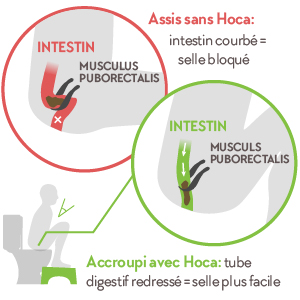 squatty potty, marche pied toilette, repose pied toilette, tabouret toilette physiologique